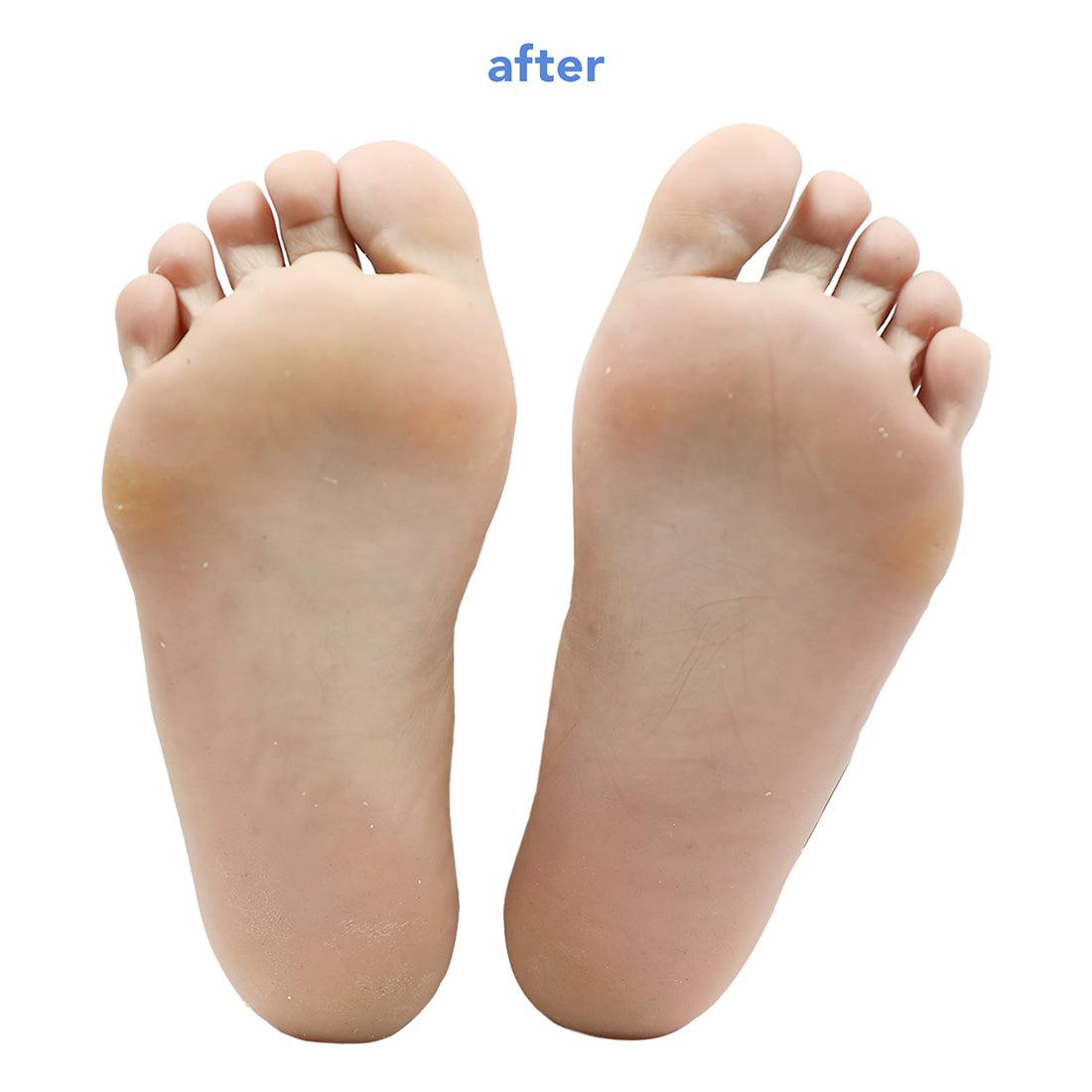 Fruit Acid Smoothing Foot Peel with plant-based alcohol - boscia