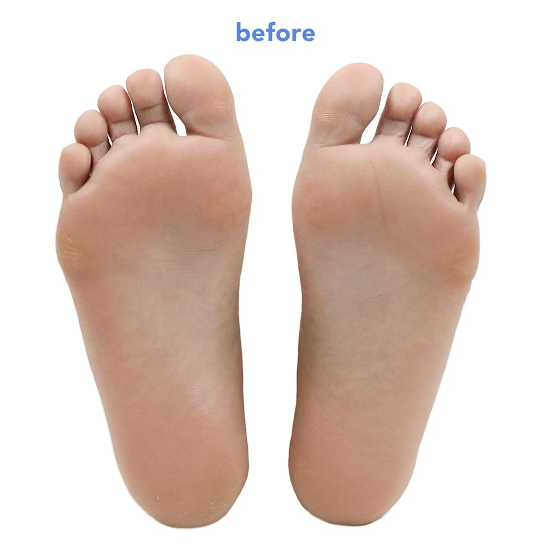 Fruit Acid Smoothing Foot Peel with plant-based alcohol - boscia