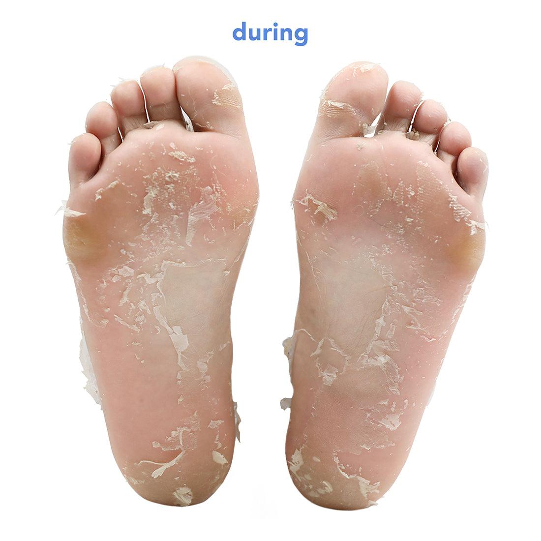 Fruit Acid Smoothing Foot Peel with plant-based alcohol - boscia