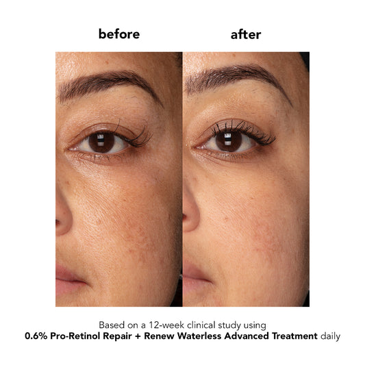 0.6% Pro-Retinol Repair + Renew Waterless Advanced Treatment