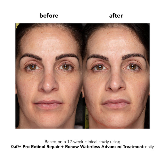 0.6% Pro-Retinol Repair + Renew Waterless Advanced Treatment